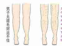 腿上无毛之人运势